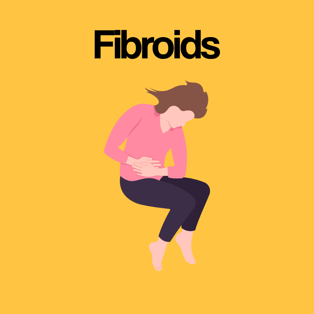 Guide by Condition: Fibroids