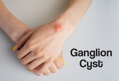 Two clasped hands – one on top of the other. There is a small, red bump on the wrist of the left hand. The words – Ganglion Cyst – can be seen