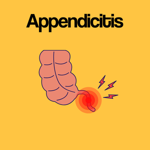 Guide by Condition: Appendicitis