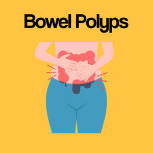 Guide by Condition: Bowel Polyps