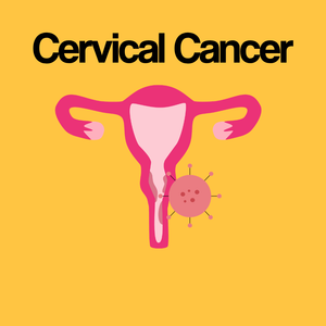 Guide by Condition: Cervical Cancer