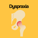 Guide by Condition: Dyspraxia