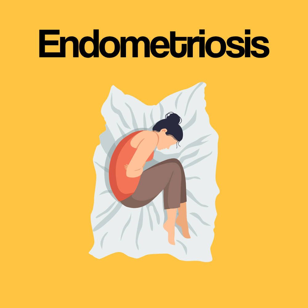 Guide by Condition: Endometriosis