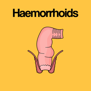 Guide by Condition: Haemorrhoids