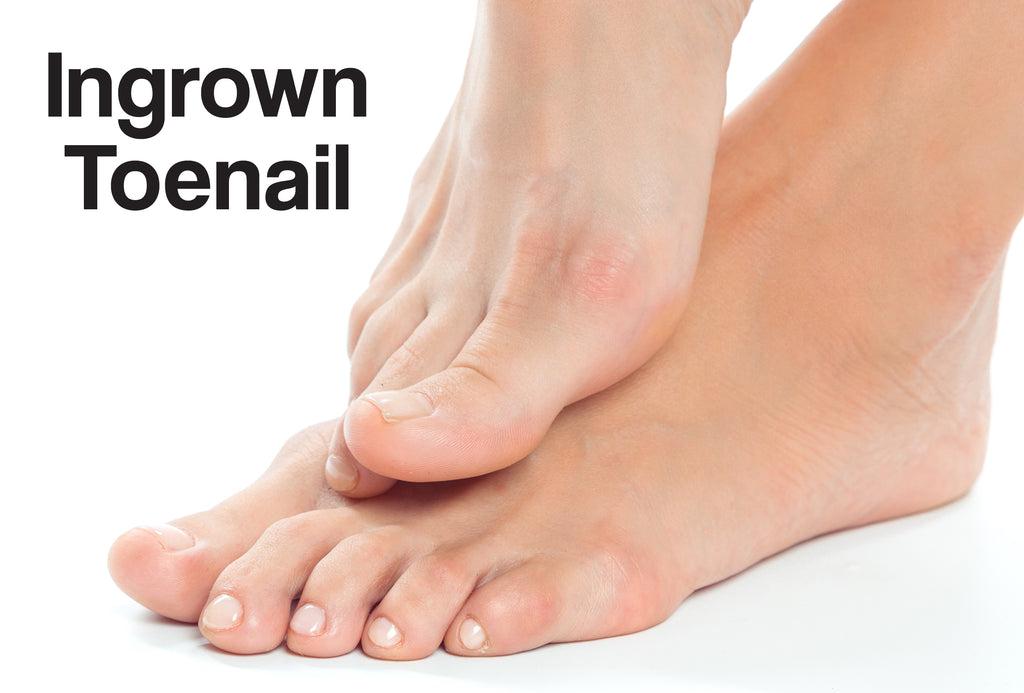 Two feet on a white background - the right hand one is 