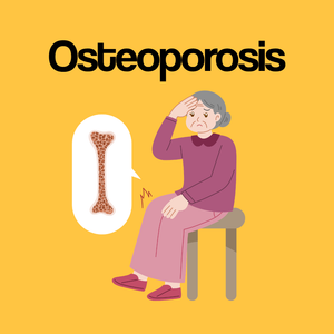 Guide by Condition: Osteoporosis