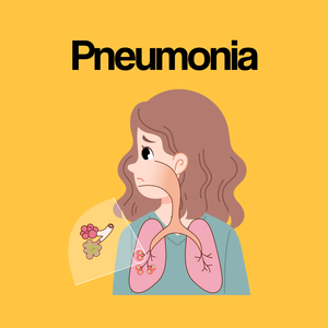 Guide by Condition: Pneumonia