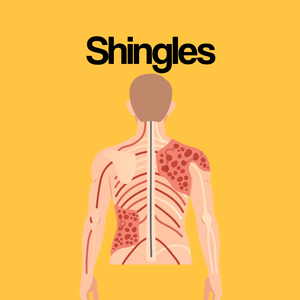 Guide by Condition: Shingles