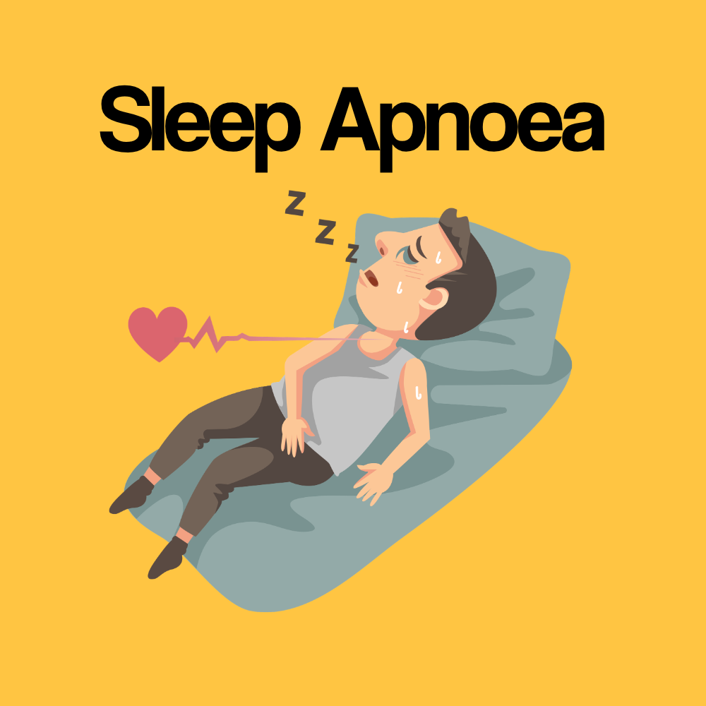 Guide by Condition: Obstructive Sleep Apnoea