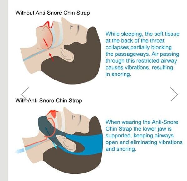 Anti Snore Chin Strap Ability Superstore