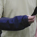shows close-up of a man's arm and hand, holding a flip-phone and wearing an outdoor cast protector